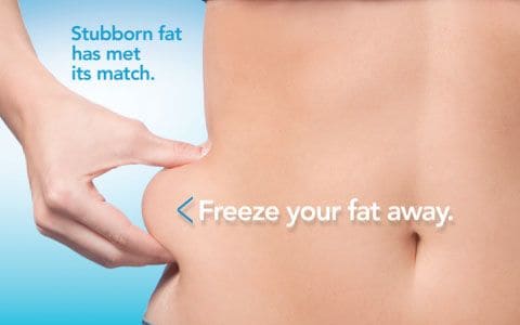 Hips treatment Southall From Lipo Sculpt