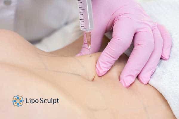 Aqualyx for Muffin Tops: What to Know Before Fat-Dissolving Injections 4 Are there risks Southall?